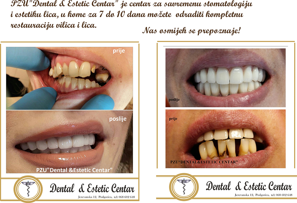 kompletna restauracija