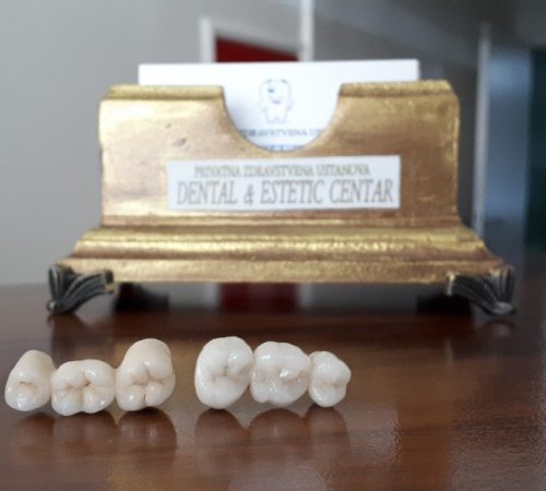 Zašto izabrati Dental estetic centar