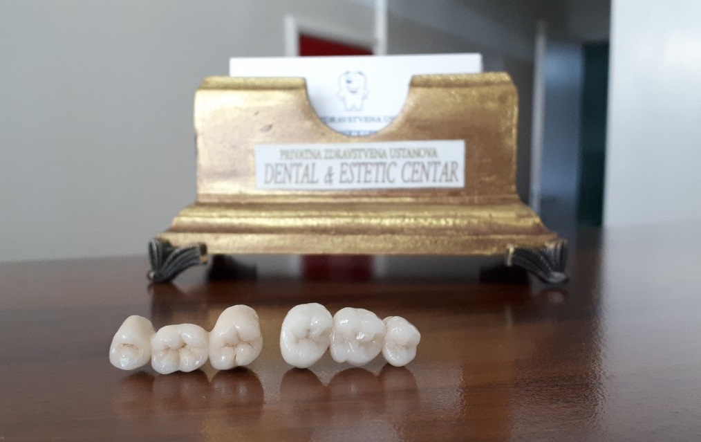 Zašto izabrati Dental estetic centar