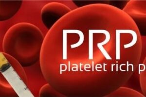 پی-آر-پی-چیست