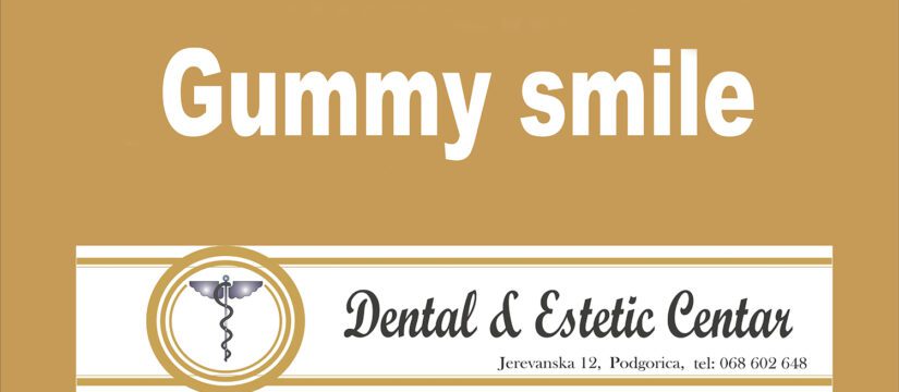Gummy Smile